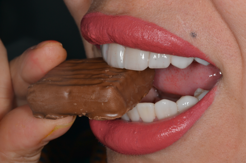 DARE — bite
